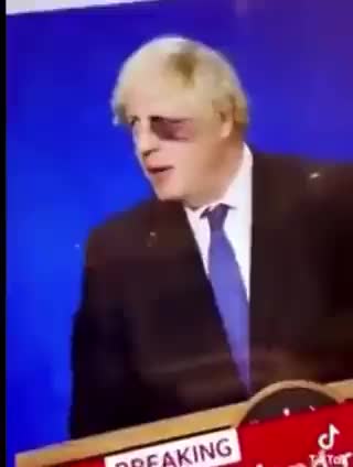 Boris Joins Black Eye Club