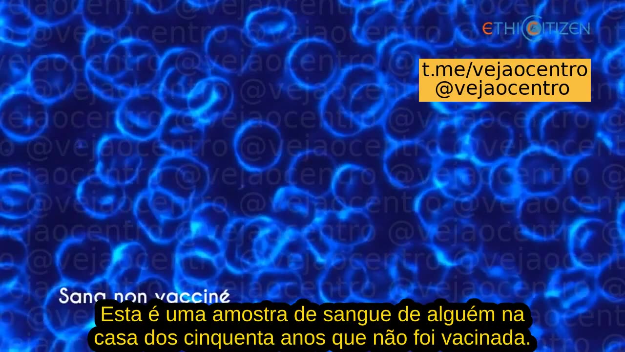 Mais novidades sobre as vacinas assassinas de Sarz Covid 19