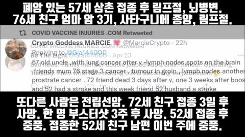 접종증상 (다양함)