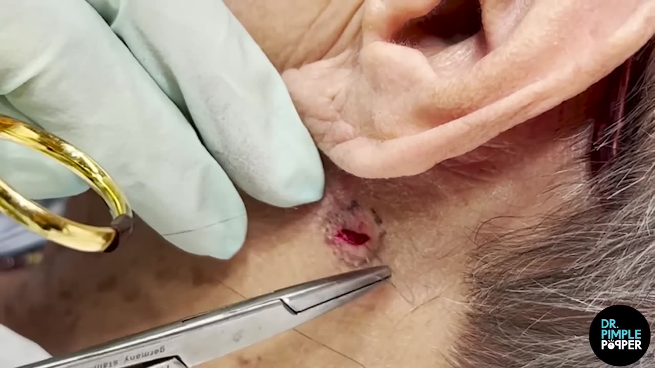 A Diamond DPOW in the Neck