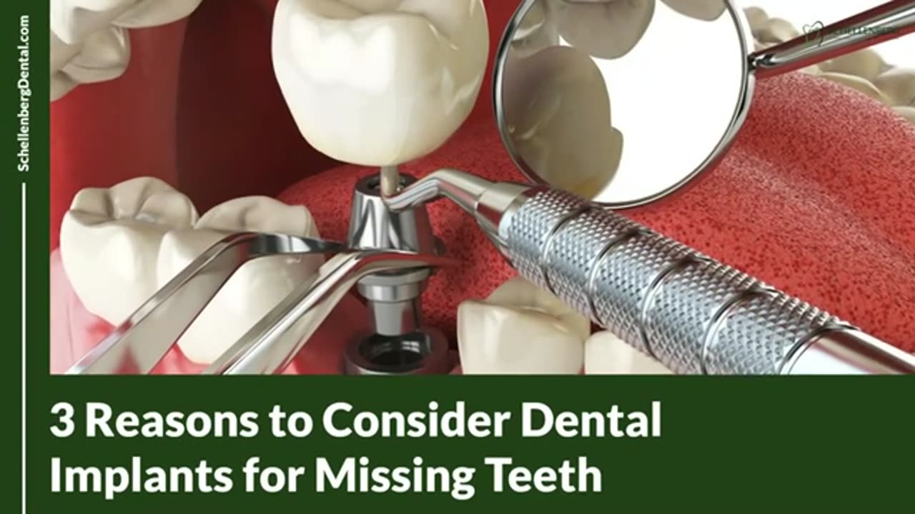 Missing Teeth? Dental Implants May Be The Best Solution For You