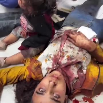 Injured children at Gaza hospital as Isreali bombing continues