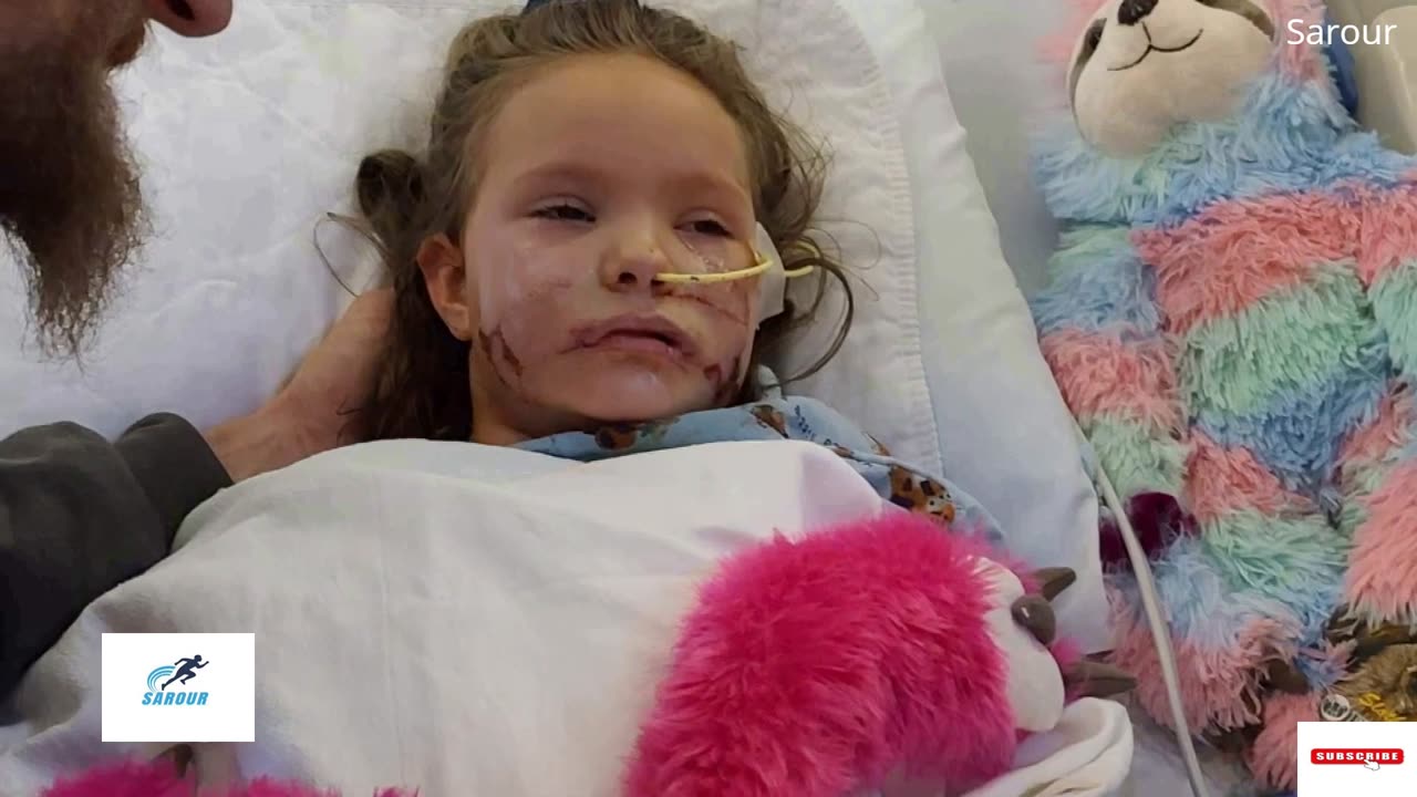 6-Year-Old Receives Over 1,000 Stitches After Dog Attack