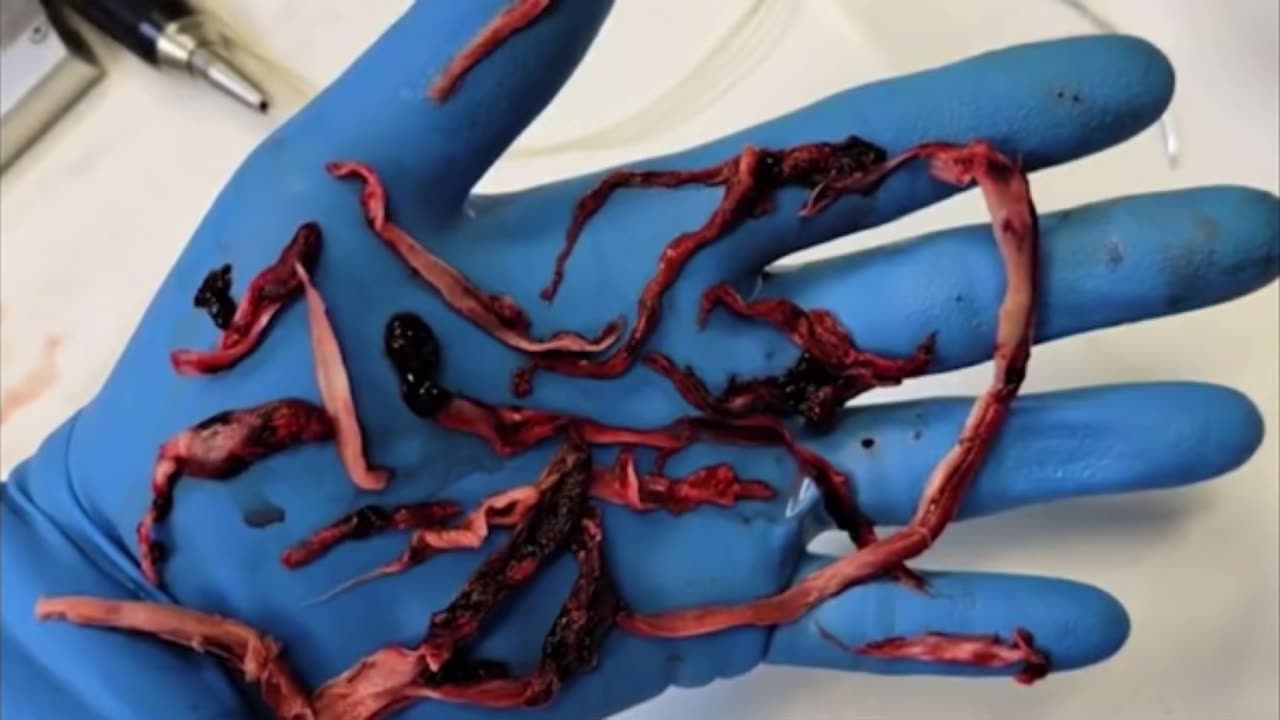 Clot Shots! Part Deux