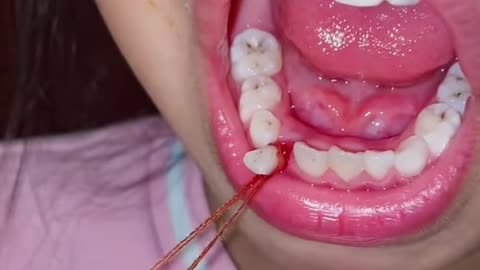 Girl teeth