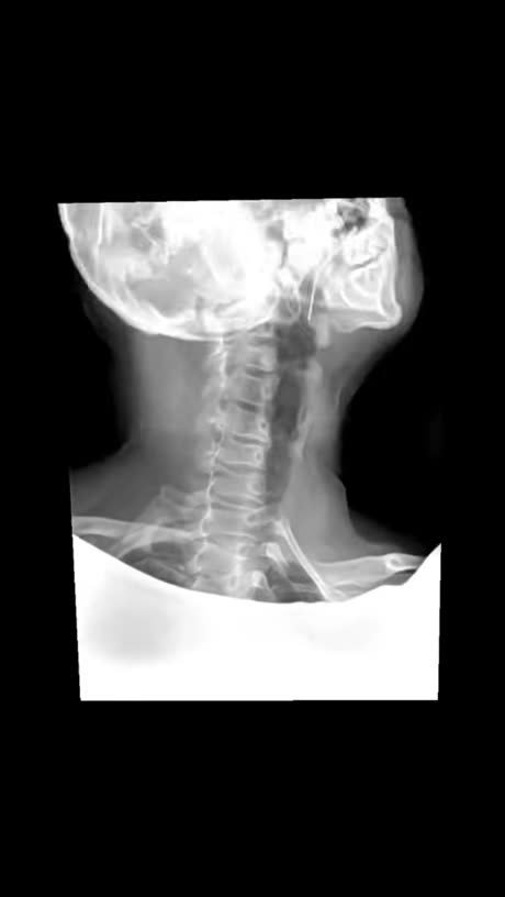 In This🌎WORLD💥🔥😎🍺