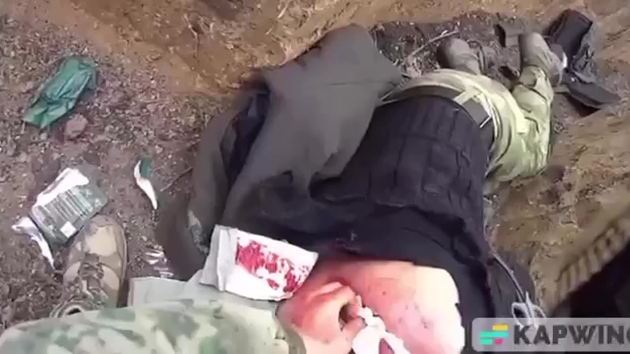 Medics Tend to a Ukrainian's Pretty Bad Shoulder Wound