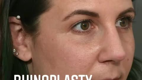 To achieve your ideal skin