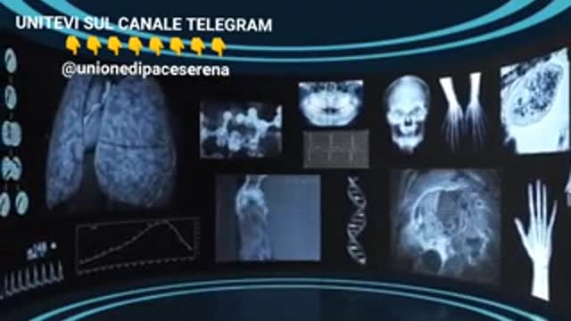 Cellule di feti umani nei vaccini