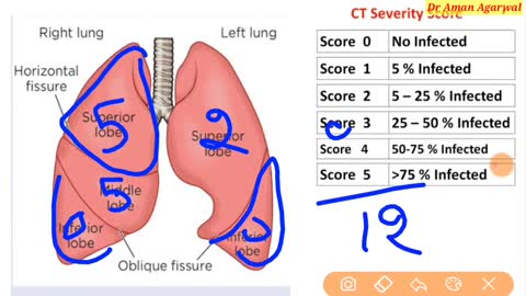 HR CT report CR SCAN REPORT FINDINGS how to correlate medical scan report