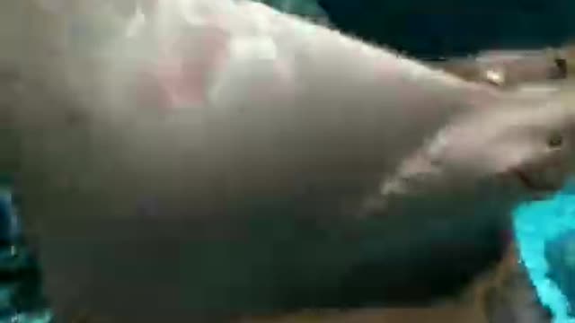 shark attack in France