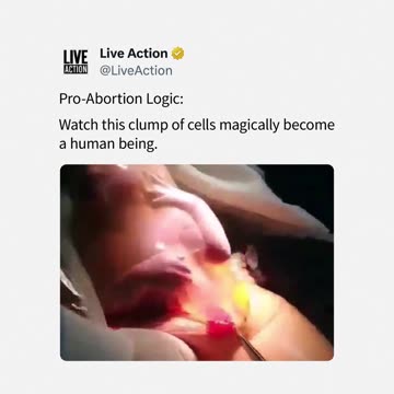 Pro-Abortion Logic Will Say This Is Just A Clump Of Cells
