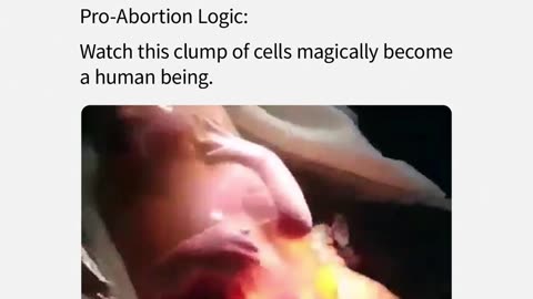 Pro-Abortion Logic Will Say This Is Just A Clump Of Cells