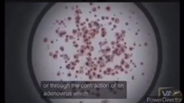 NEURO technology.