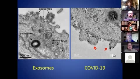 Re-Upload: Dr. Andrew Kaufman Exosomes