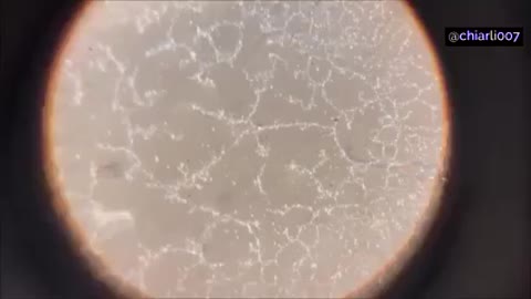 Електронна микроскoпия на съдаржанието на ваксините