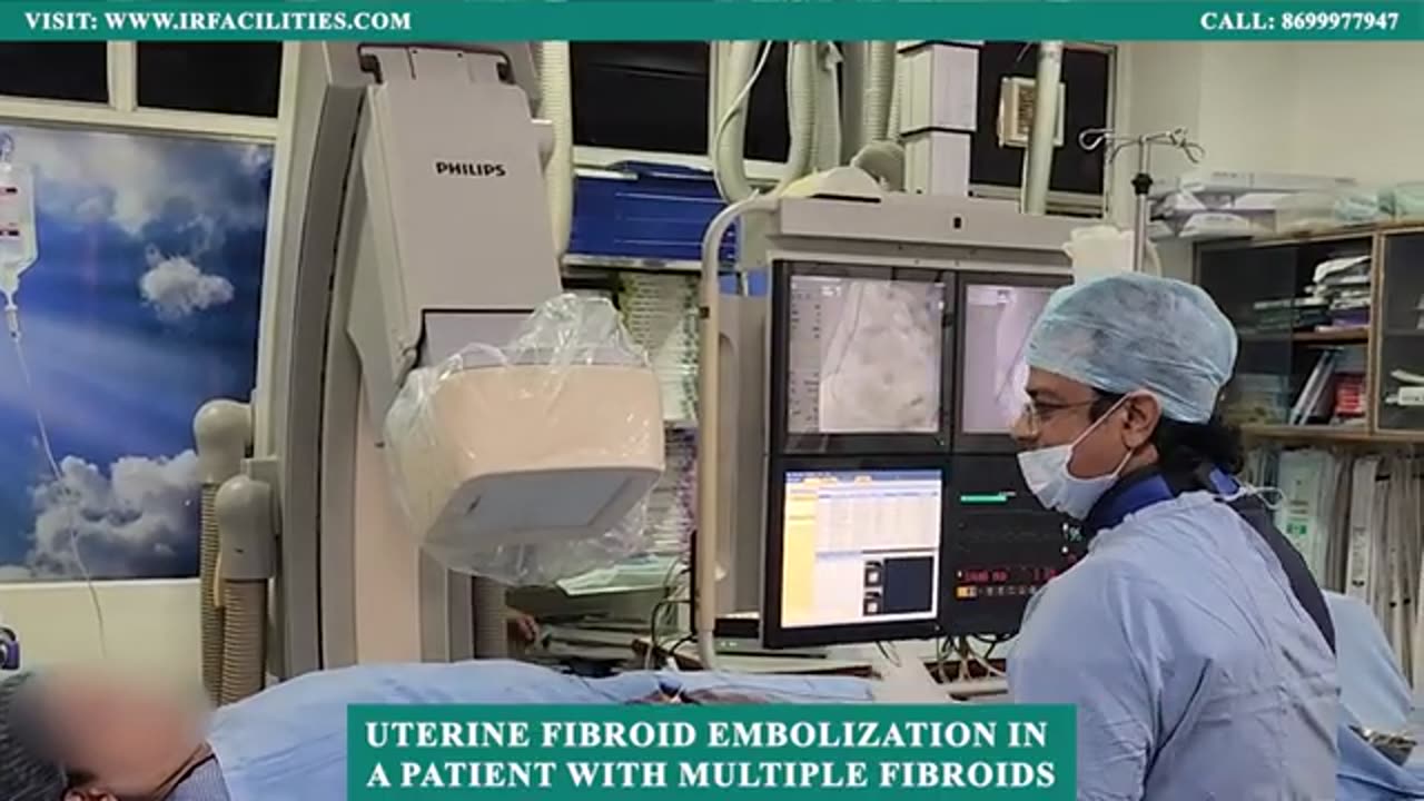 Uterine Fibroid Embolization for Multiple Fibroids | Dr. Sandeep Sharma | IRFACILITIES