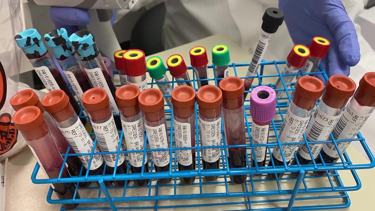 Covid vaccine is a fraudulent product caused millions of injuries and deaths