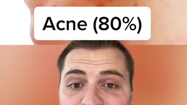 How rare is your body ?