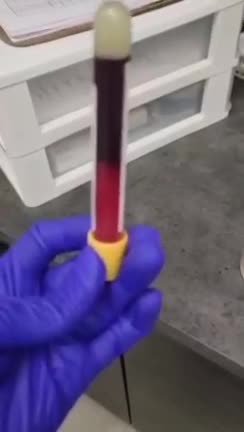 Apparently this is the blood of a vaccinated person