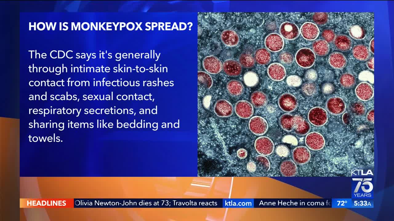 Monkeypox vaccine clinic opens in East Hollywood