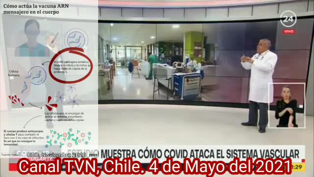 🚫TVN. Dr. Ugarte, el COVID No se considera una enfermedad respiratoria,