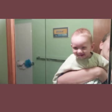 burns over his reflection