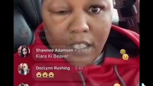 Lady Got a Big Ass Head From the J&J Vaccine