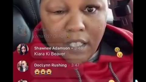 Lady Got a Big Ass Head From the J&J Vaccine