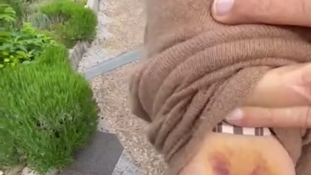 Are Keys Sticking to Vaccination Sites Now? 😳