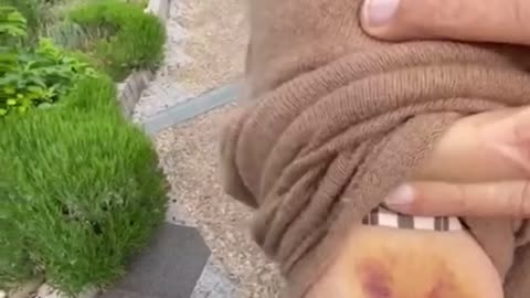 Are Keys Sticking to Vaccination Sites Now? 😳