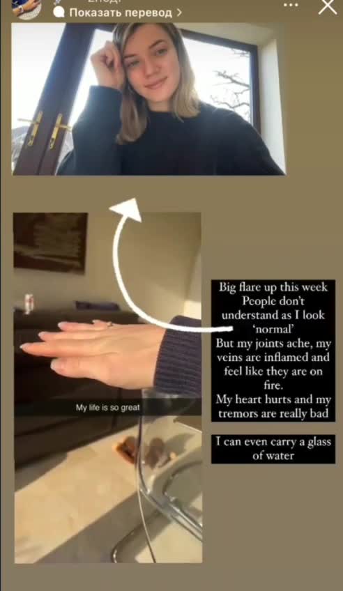 Reazioni avverse al siero genico... orrore 118