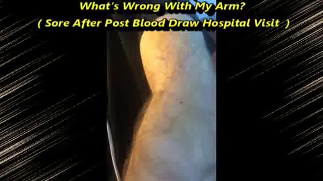 What’s Wrong With My Arm? Visit His Channel Please