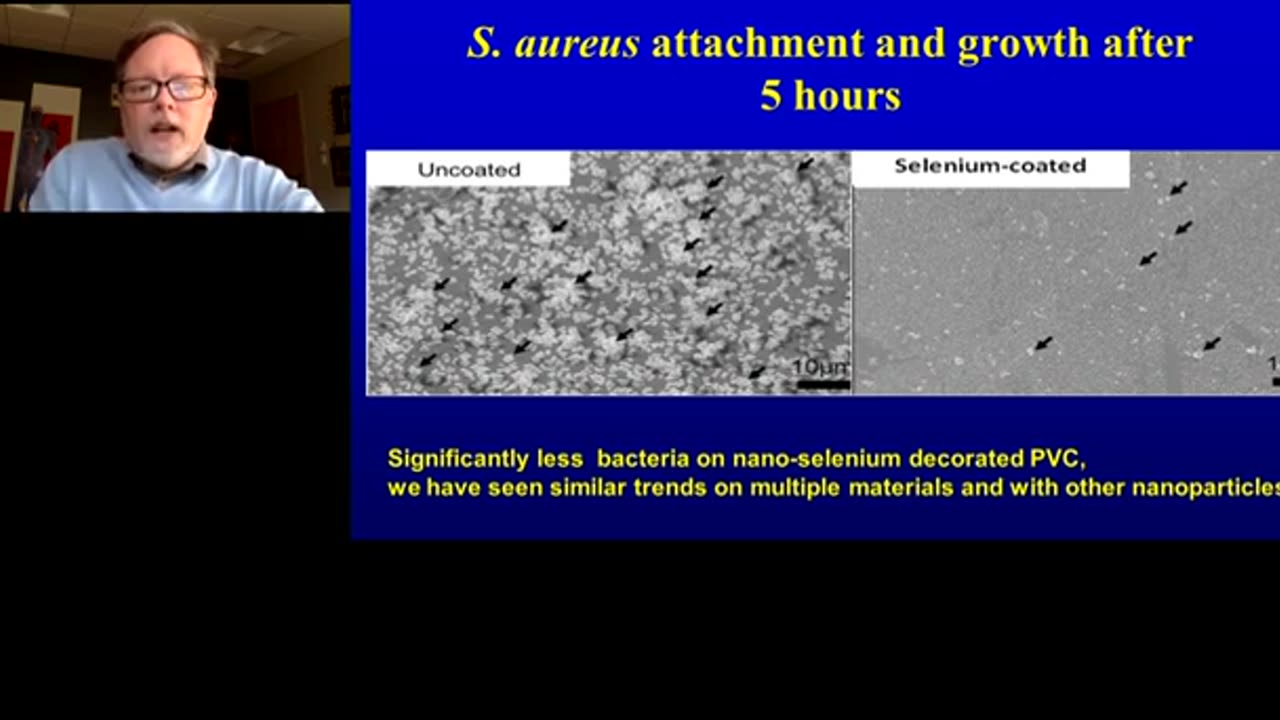 Commercializing Nanomedicine for Improving Human Health: Not Just Hype, It Is Really Happening! Thomas Webster, PhD Professor and Department Chair, Chemical Engineering, Chair in Engineering, Bioengineering, Northeastern University