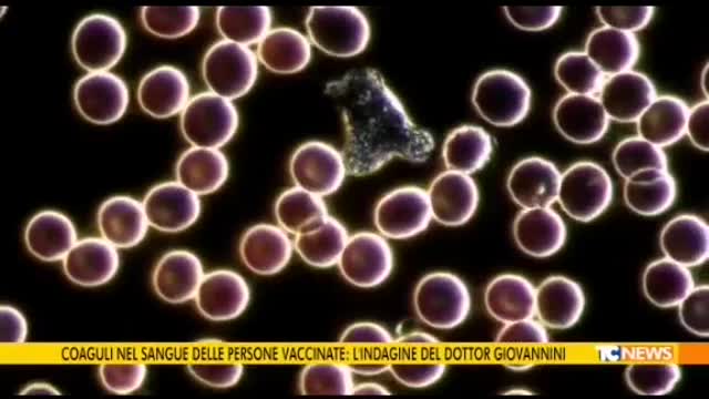 Coagulazione del sangue a causa dei Vaccini covid19