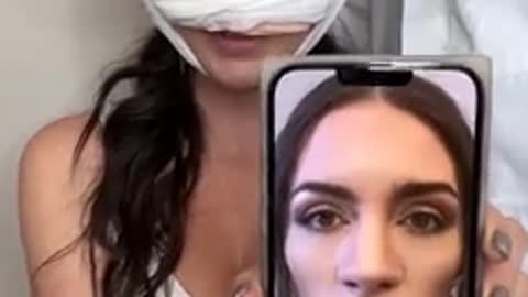CRAZIEST nose job transformation I've ever seen!!