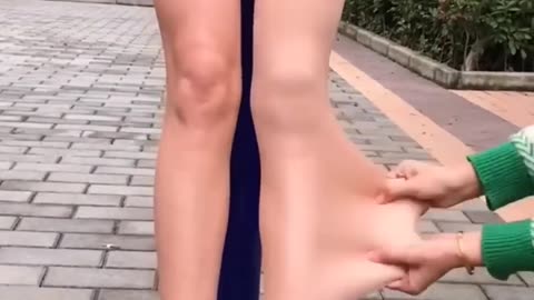 Stretching of skin of body