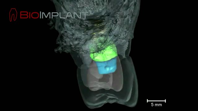 *** µCT OF A ROOT ANALOGUE DENTAL IMPLANT ***