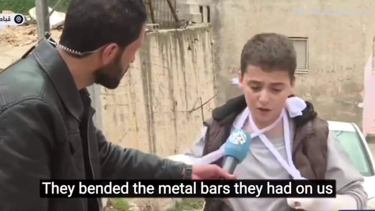 ►🚨▶◾️🇮🇱⚔️🇵🇸 Mohammed Nazzal, Palestinian youth HELD CAPTIVE BROKE HIS FINGERS ARMS