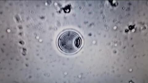 [펌] 백신에서 발견된 괴생명체