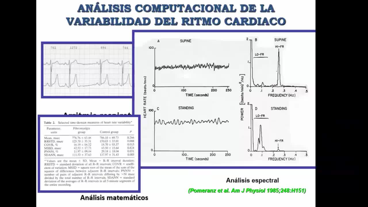 Fibromialgia Dr Manuel Martinez Lavin