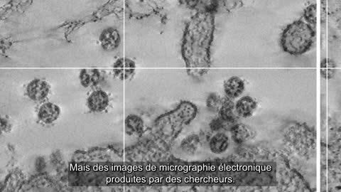 Virus jamais isoler - Virus never isolated