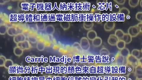 打了AZ的人 血液裡竟然有電子設備