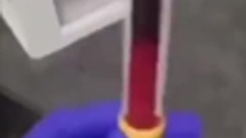 Vaccinated blood is garbage. Check this out.💉🩸🩸🩸