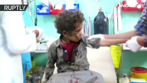 U napadu u Jemenu pobijeno 29 djece