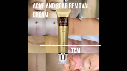 #Shorts: Acne and Scar Removal Cream