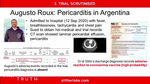 Augusto Roux: Pericarditis in Argentina #AllTheRisks