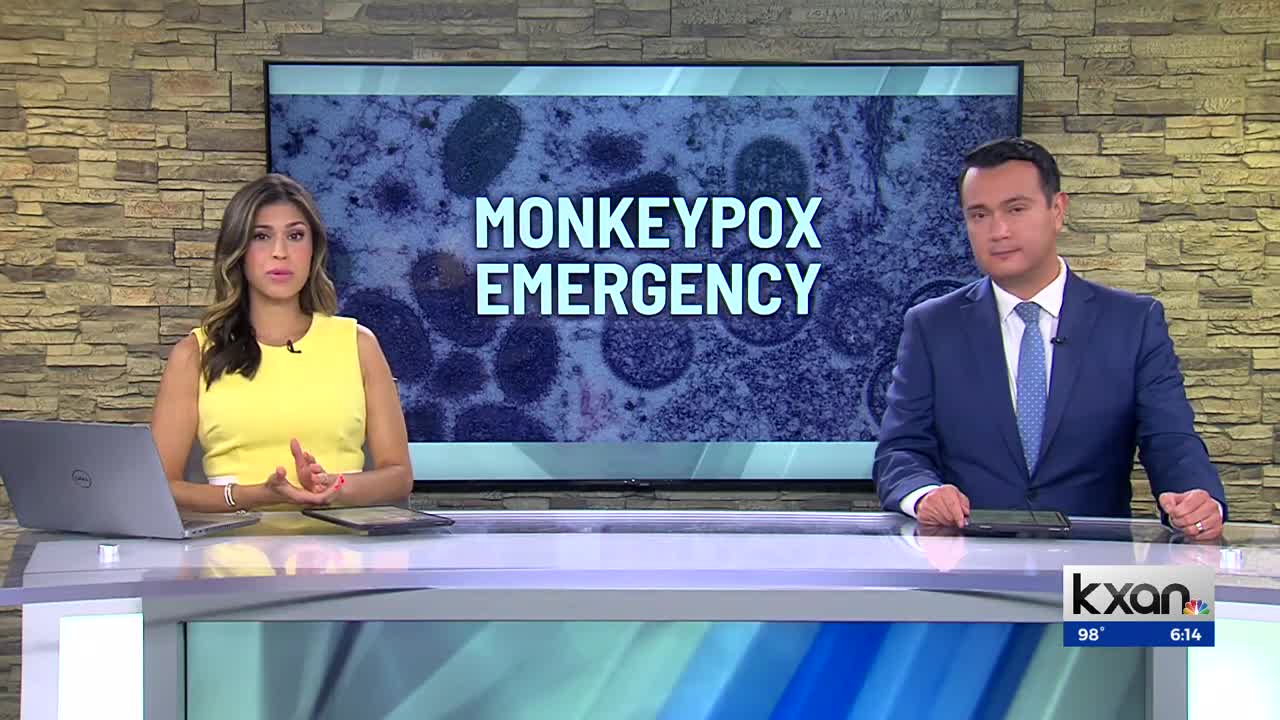 How Austin-Travis County EMS is responding to monkeypox calls