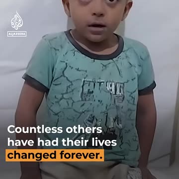Palestinian child in shock after surviving Israeli attack in Gaza