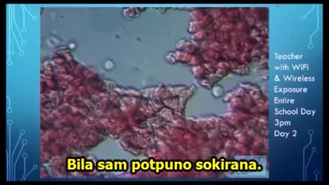 Tumačenje povezanosti nastanka erktrocitnih mikrogregata i elektromagnetskog zračenja 5G.